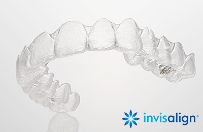 03.マウスピース型矯正装置（インビザライン)
